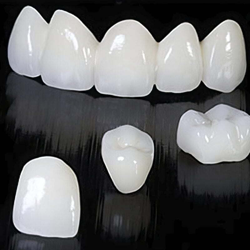 Couronne full zircone multicouche – Prothèse dentaire 100% zircone, translucide et résistante, pour une restauration durable et esthétique 2