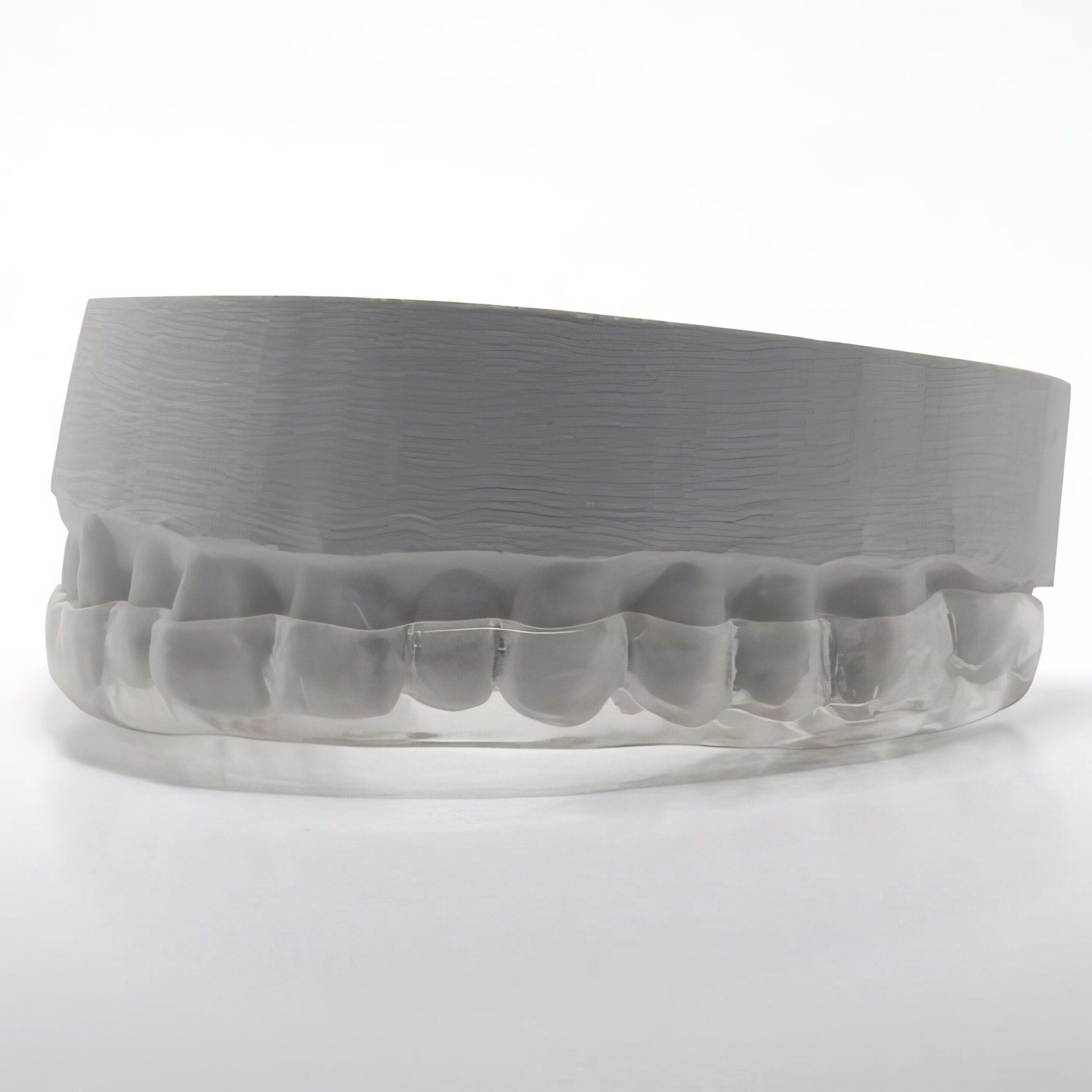 Gouttière de bruxisme sur mesure - Protection efficace contre le grincement des dents et l'usure dentaire