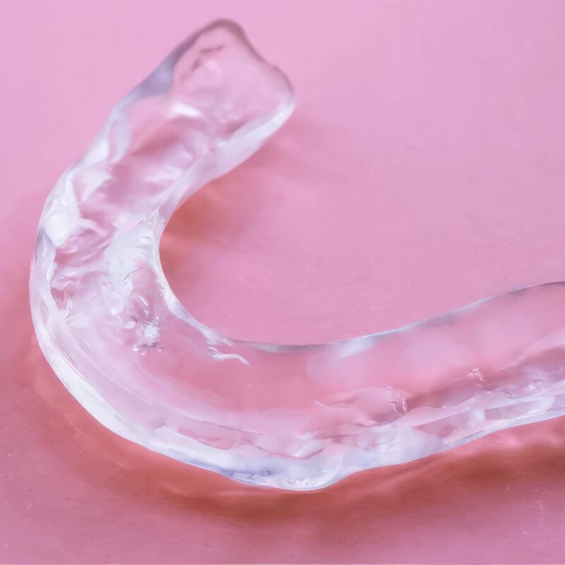 Gouttière occlusale thermoformée - Solution personnalisée pour limiter le bruxisme et soulager les tensions musculaires