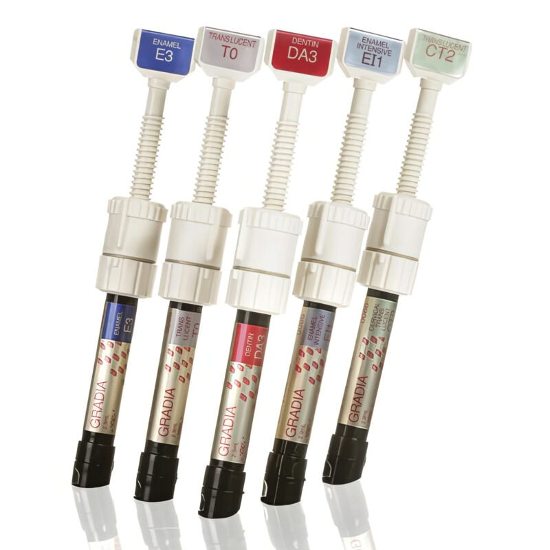 Inlay Onlay composite – Solution esthétique et durable pour restaurer la dentition, alternative moderne aux obturations traditionnelles 1