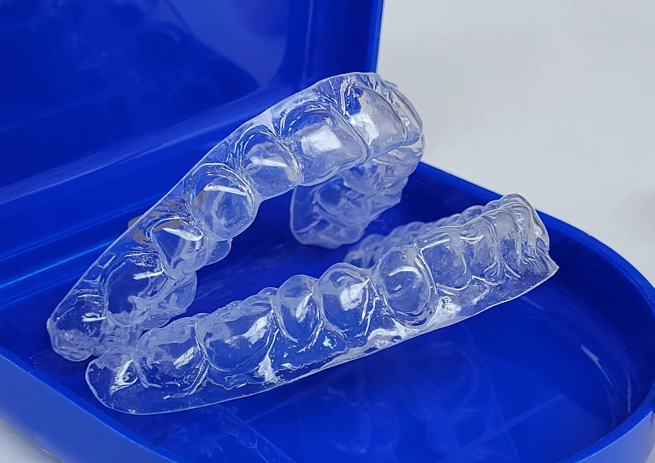 Mascherina sbiancante su misura - Sbiancamento efficace e fluorizzazione per rinforzare lo smalto e migliorare l’estetica dentale