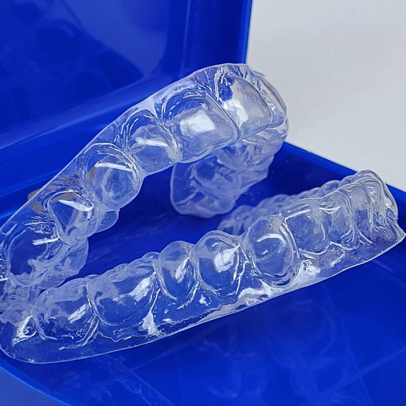 Mascherina sbiancante su misura - Sbiancamento efficace e fluorizzazione per rinforzare lo smalto e migliorare l’estetica dentale